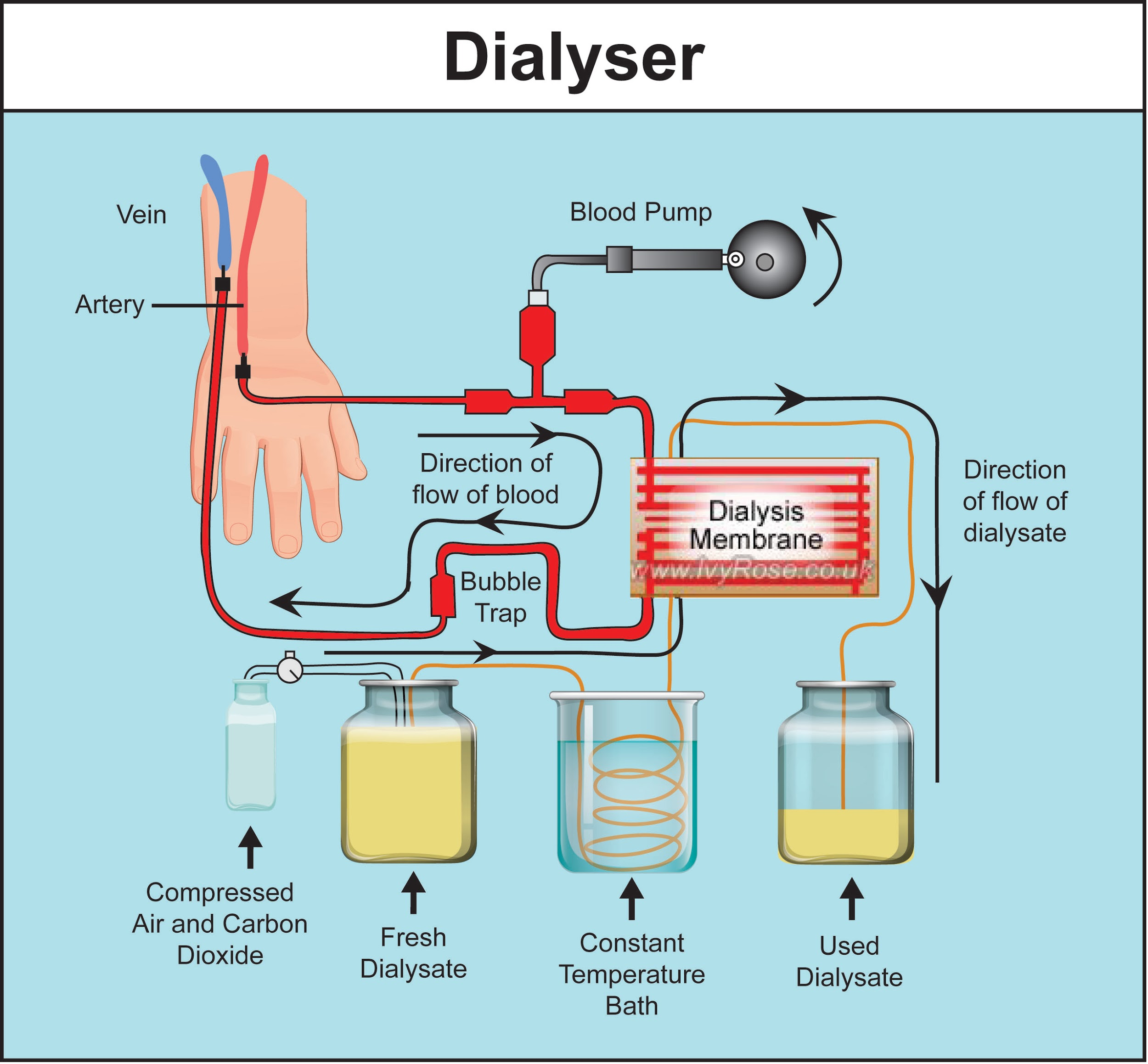 assertionin-dialyzer-the-plasma-protein-of-the-blood-cannot-be