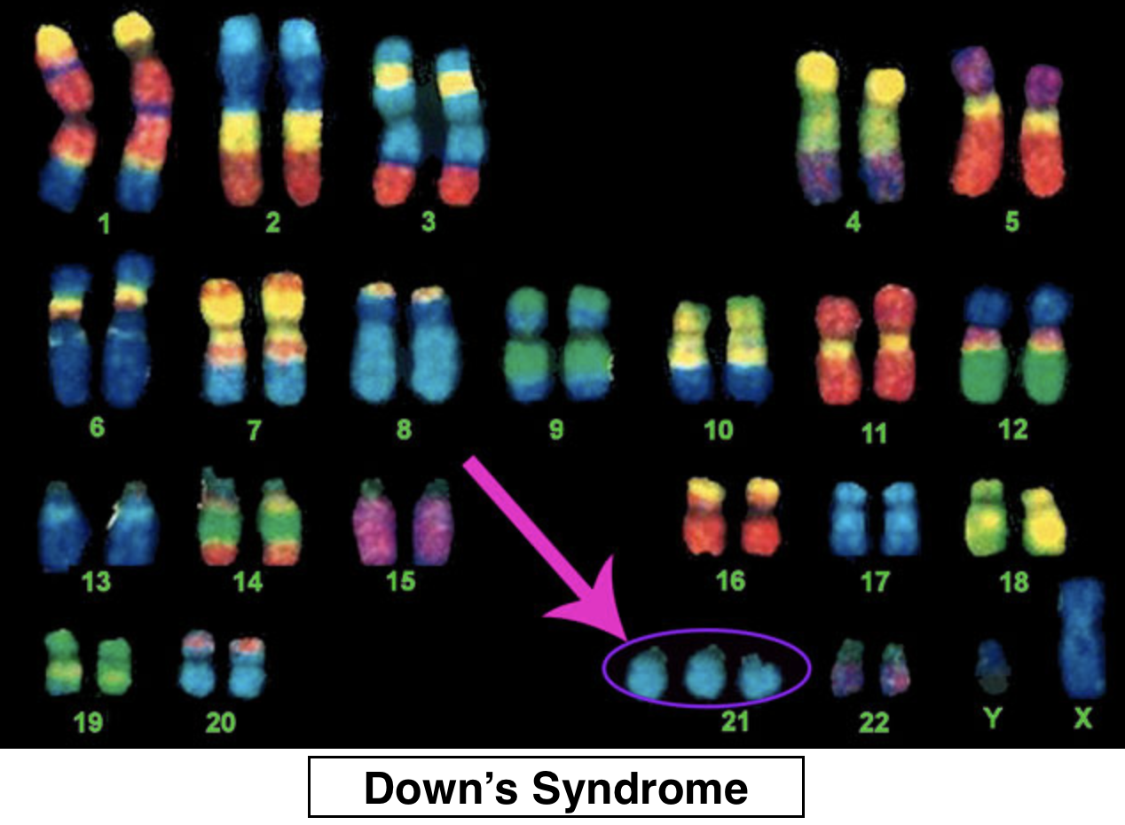 is down syndrome autosomal or sexlinked
