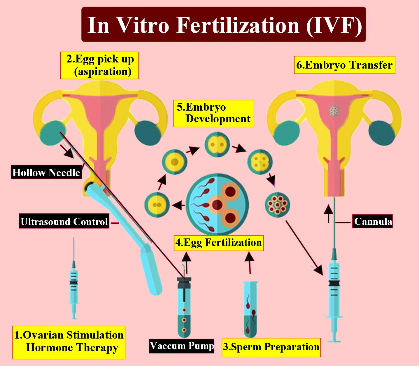 Suggest and explain the assisted reproductive techniques which will help a couple to have children, where the female had a blockage in the fallopian tube and the male partner had a low