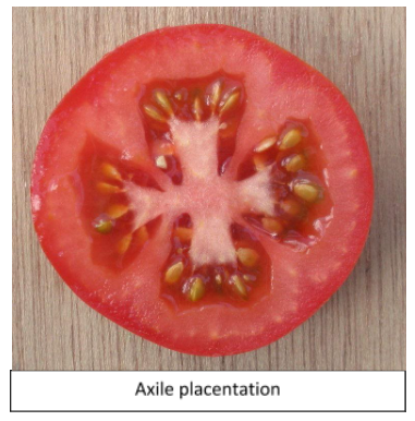 placenta placentation ovules arrangement basal