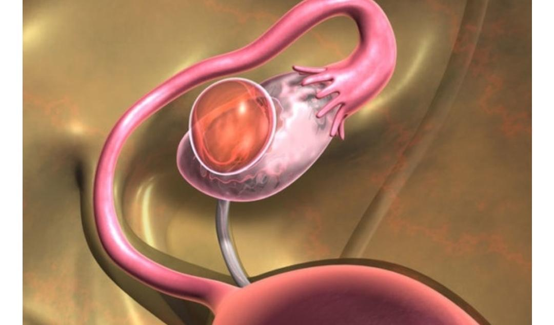 The fusion of male and female gametes usually takes place inside the A.  Uterus B. OvaryC. Fallopian tubes D. Zygote