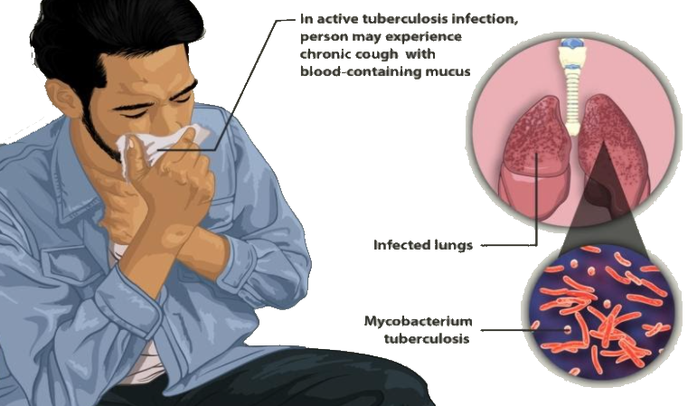 Describe Disorders Of The Respiratory System