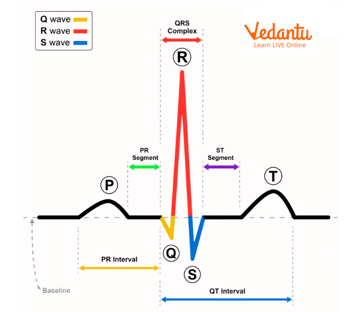 Schematic representation of a normal sinus rhythm ECG wave