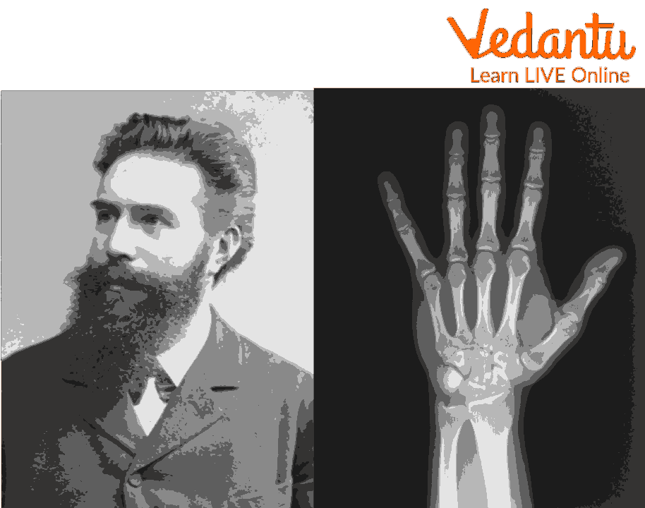 Wilhelm Rontgen - Physicist Who Discovered X-rays