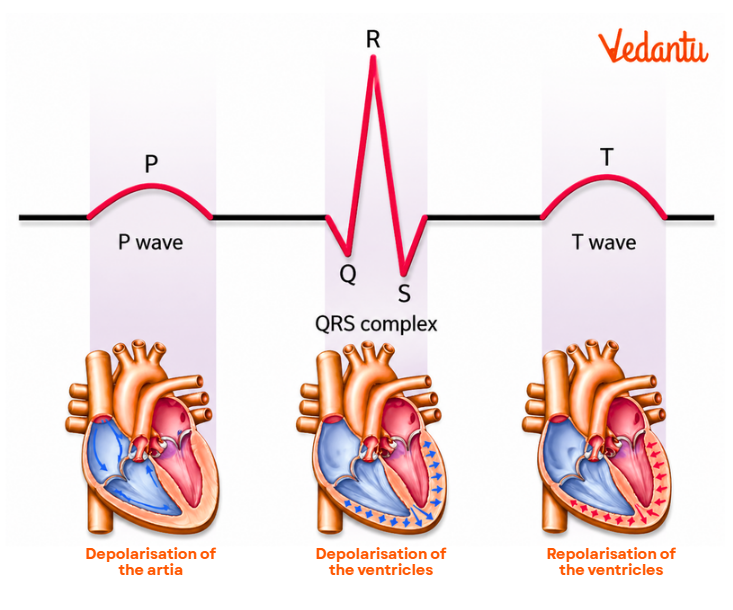 Components of the QRS Complex Diagram