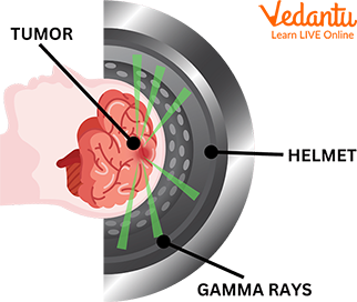 Gamma Rays Used for Cancer Treatment