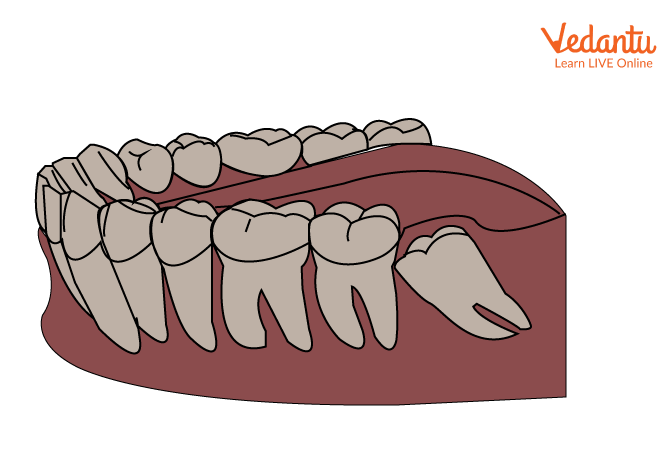 Teeth Structure