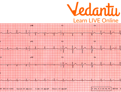 The Graph is an ECG