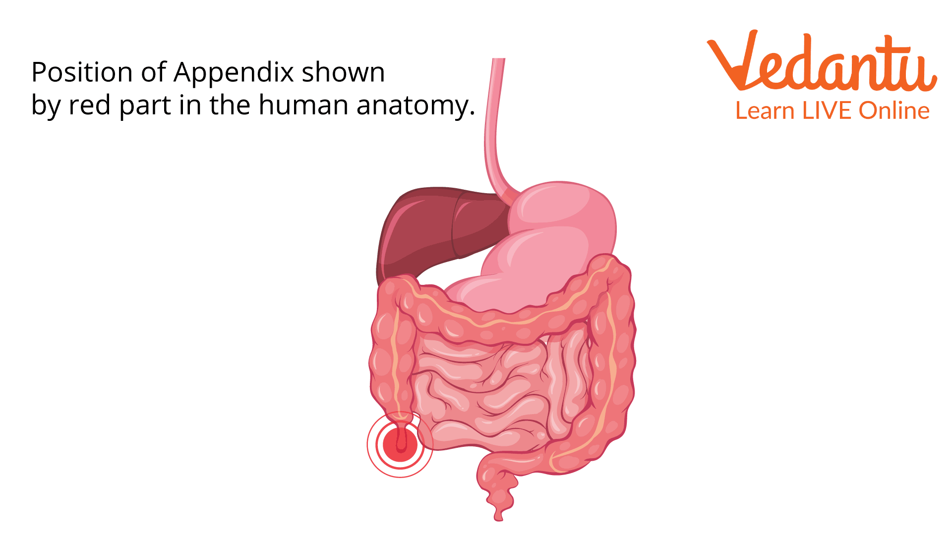 The Position of the Appendix is Shown as the Red Part of the Human Anatomy.