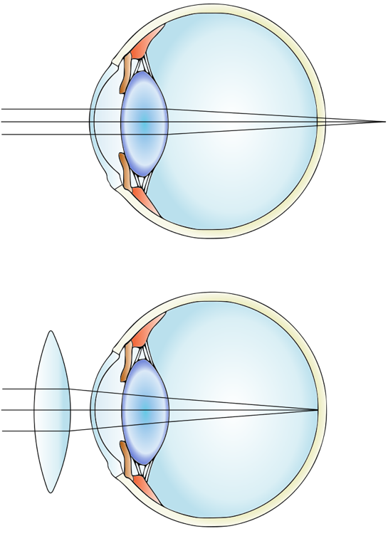 Uses of Convex Lens Plano Convex and Biconvex Lens